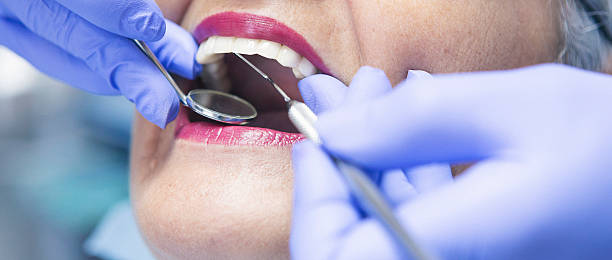 Best Emergency Treatment for Dental Infections or Abscesses in Roberta, GA